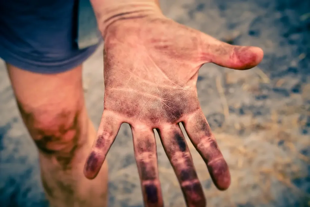Melhores clínicas dermatológicas em Piracicaba: 10 opções imperdíveis para cuidar da sua pele