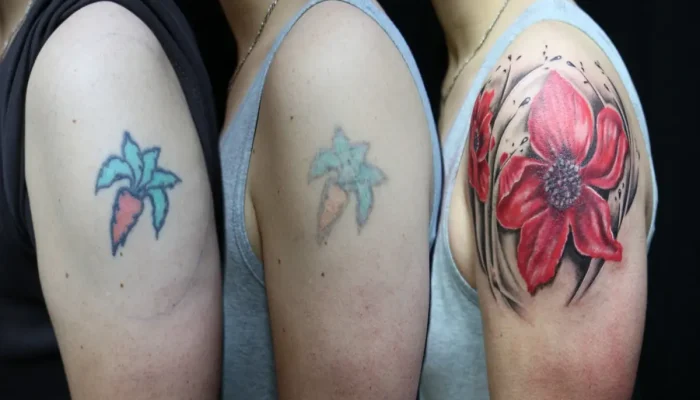 Melhores clínicas de depilação a laser em Piracicaba: Top 10 para você conhecer