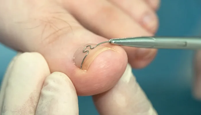 Melhores clínicas de estética em Piracicaba: Top 10 que você precisa conhecer