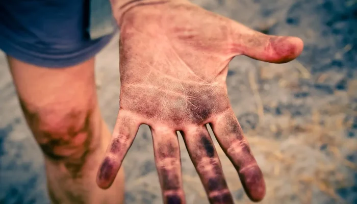 Melhores clínicas dermatológicas em Piracicaba: 10 opções imperdíveis para cuidar da sua pele